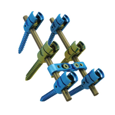 Sistema de fixação espinhal SAFE
